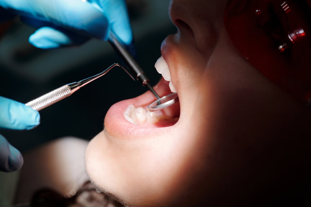 Crafting Captivating Headlines: Your awesome post title goes here Primer plano detallado de una revisión dental con instrumental y paciente bajo una luz brillante.